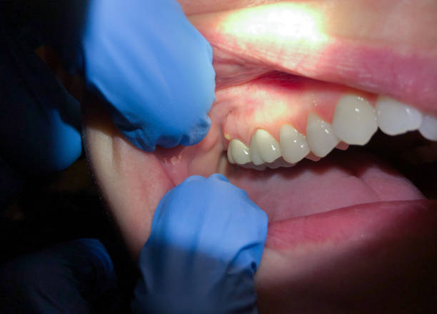 Best Emergency Dentist for Knocked-Out Tooth in Makaha, HI